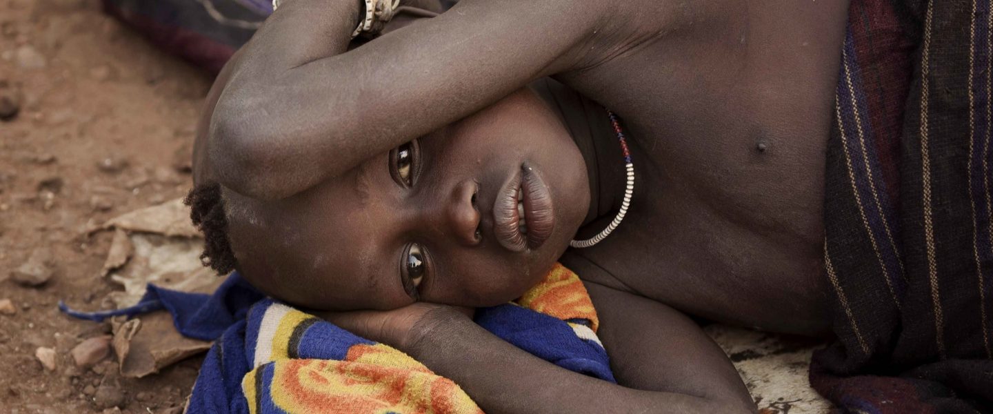 child, malaria, ethiopia